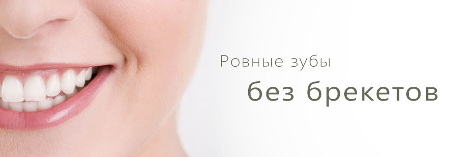 Invisalign. Ровные зубы без брекетов