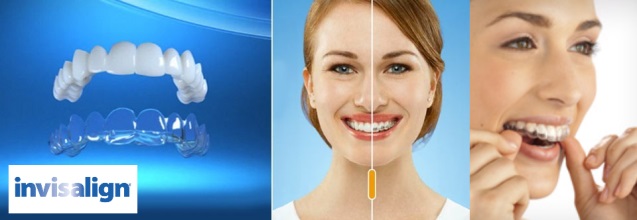 Почему Invisalign - сравнение с брекетами Почему Invisalign - сравнение с брекетами